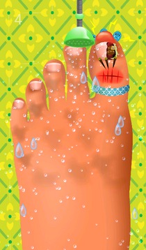 Feet Hospital Operating Games游戲截圖2