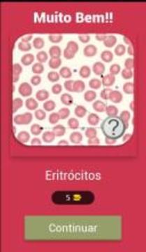 Questionário de Hematologia游戲截圖2