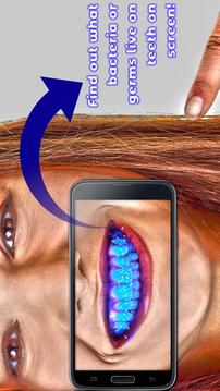 Teeth Germ Scanner Simulator App游戲截圖4