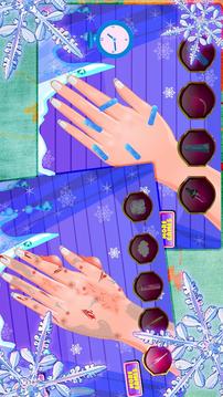 Beauty Girl Nails Heal Spa游戲截圖1