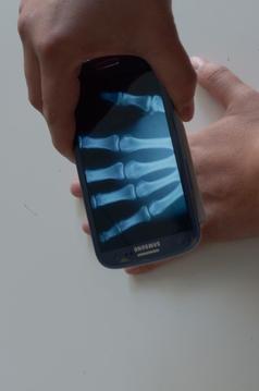Xray Prank游戲截圖1
