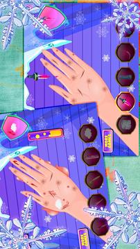 Beauty Girl Nails Heal Spa游戲截圖4
