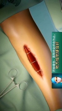 骨折手術(shù)游戲截圖3