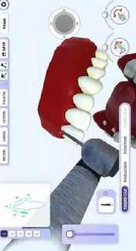 牙医模拟游戏截图1