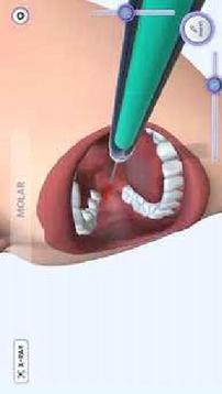 牙医模拟游戏截图3