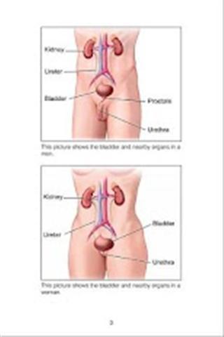 膀胱癌的症状及原因截图2