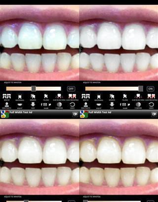 Virtual Dentist截图4