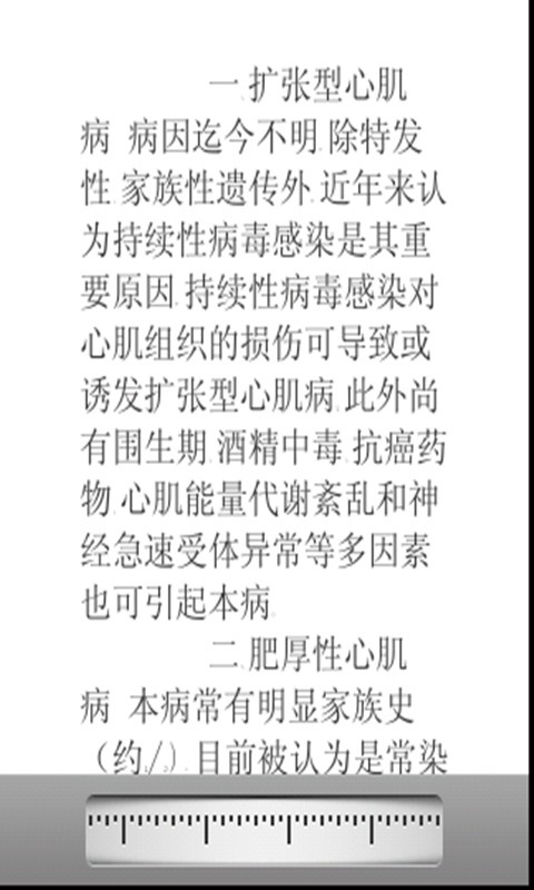 心肌病治疗截图2