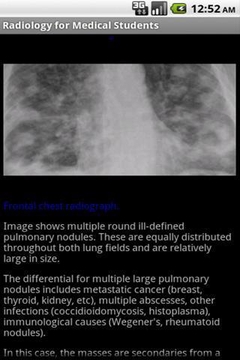 Emergency Radiology Lite截图