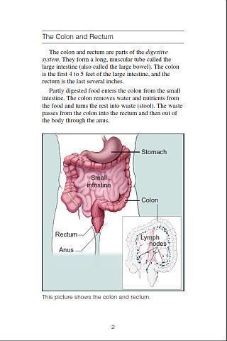 Colon Cancer截图3