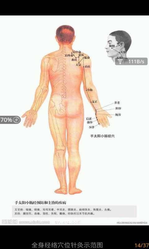 全身经络穴位针灸示范图截图4