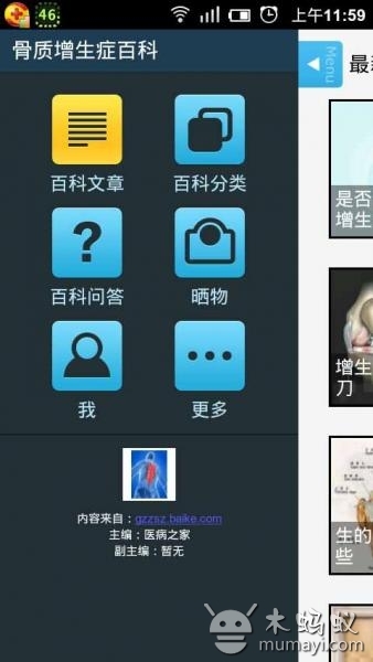 骨质增生症百科截图1