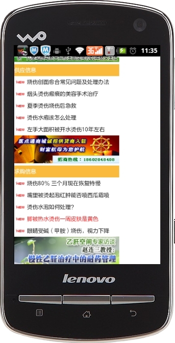 烧伤烫伤截图4