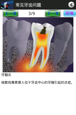 锋玲保护牙齿截图3