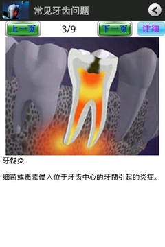 锋玲保护牙齿截图