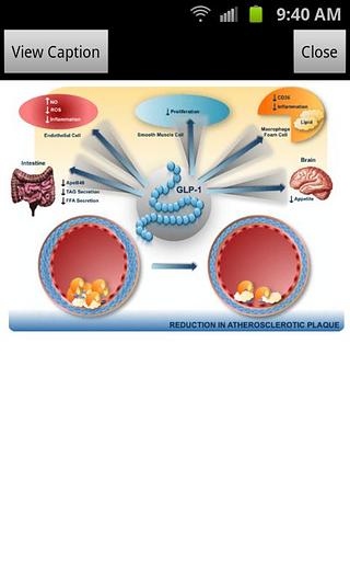 Endo Pubs截图8