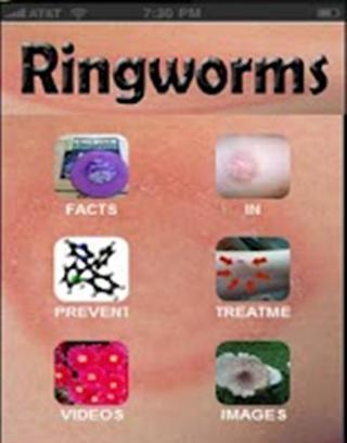 癣 RINGWORMS截图3