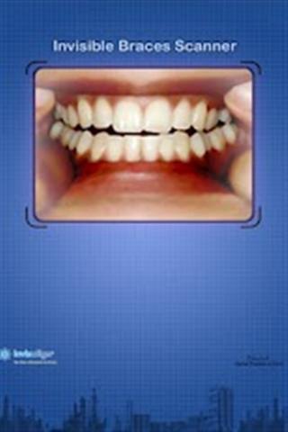 Invisible Braces Scan截图1