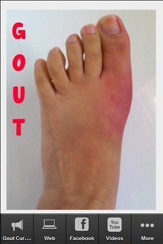 Gout Cure截图1