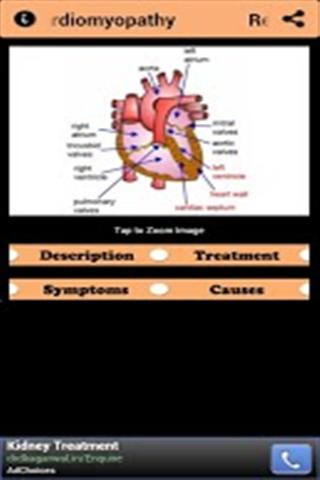 所有的心脏疾病截图1