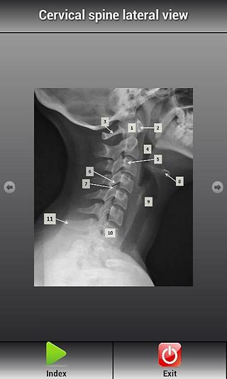 Human X-ray Anatomy Lite截图2