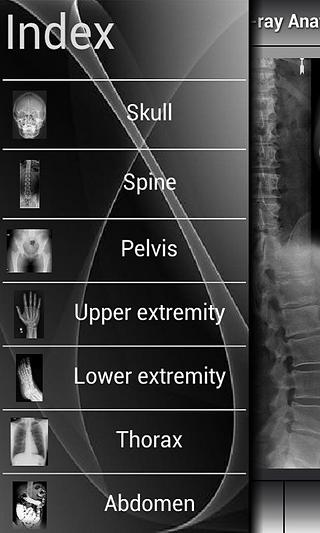 Human X-ray Anatomy Lite截图4