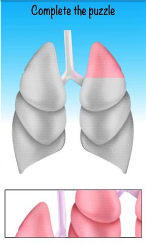 儿童认识哮喘截图1