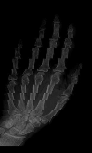 Body X-ray Scanner截图3