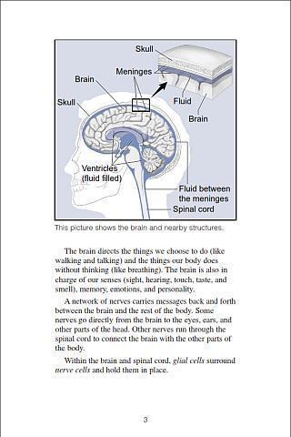 Brain Tumors截图3