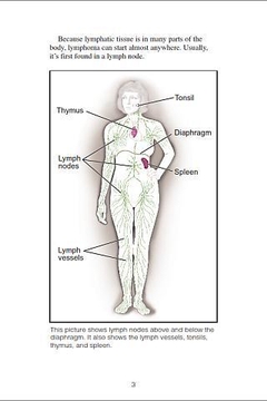 Non-Hodgkin Lymphoma截图