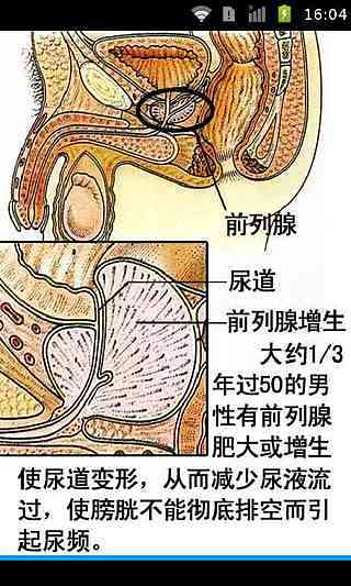 人体地图器官病理分析截图2