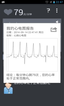 心跳心电图截图