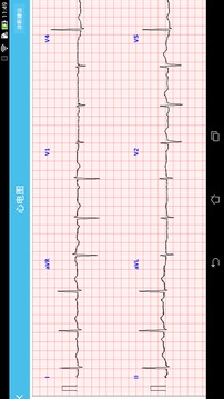 心电监护截图