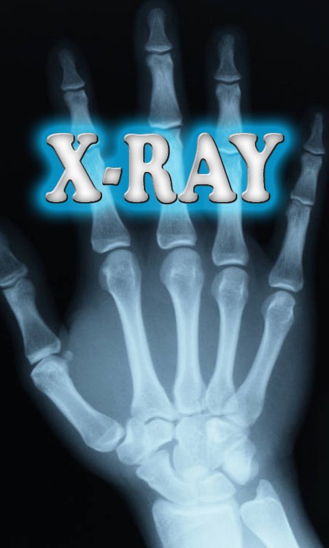 x射线扫描仪 X-Ray Scanne...截图3