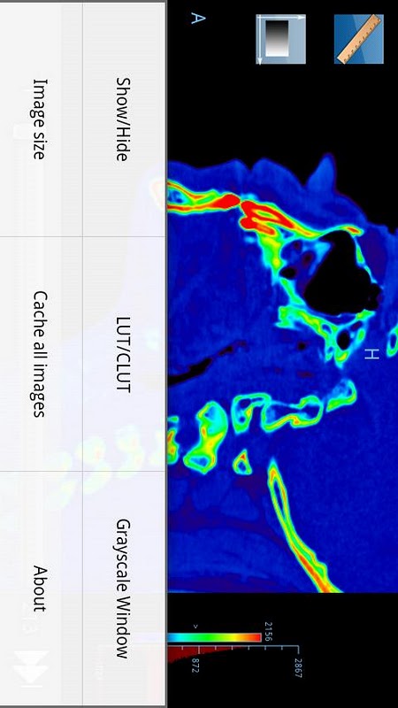 Droid Dicom Viewer截图3