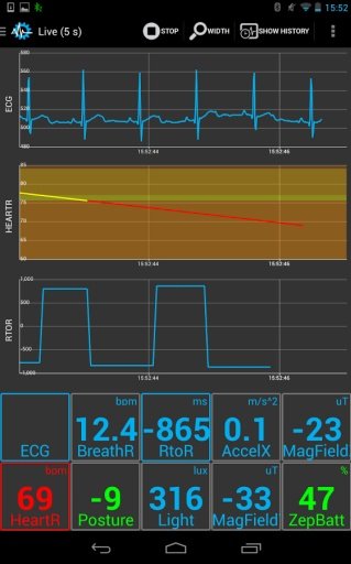 SenseView BT OBD2 Sensor截图3