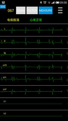 家用心电截图3