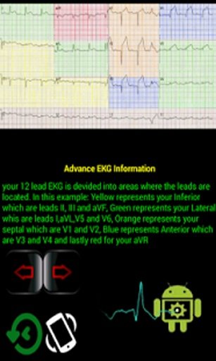 EKG Master截图5