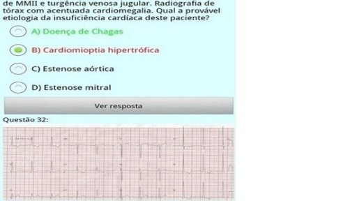 Desafios de ECG Lite截图4