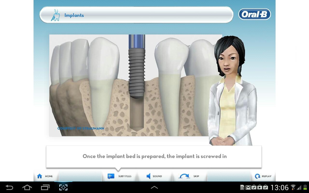 Dental Implants - by Oral-B截图4