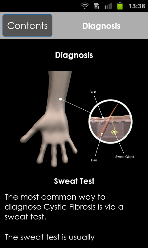 Cystic Fibrosis:A Pocket...截图3