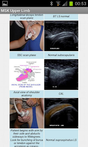 MSK ultrasound upper limb Lite截图1