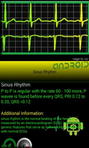 EKG Master截图4