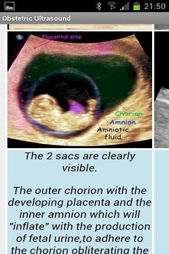 Obstetric Ultrasound-Lite截图
