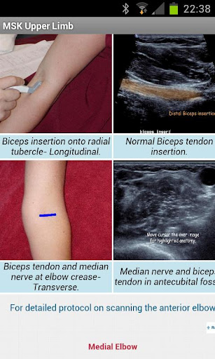 MSK ultrasound upper limb Lite截图5