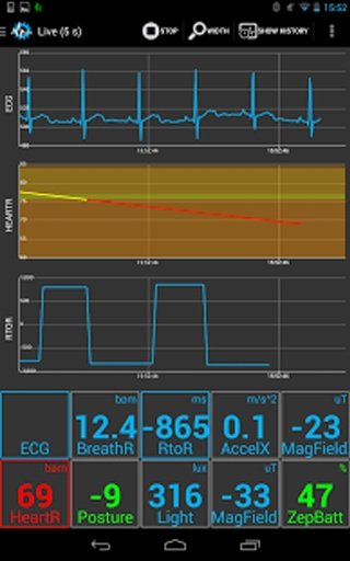 SenseView BT OBD2 Sensor截图4