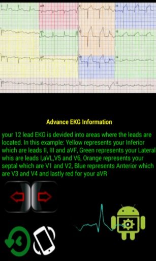 EKG Master截图6