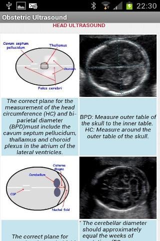 Obstetric Ultrasound-Lite截图5