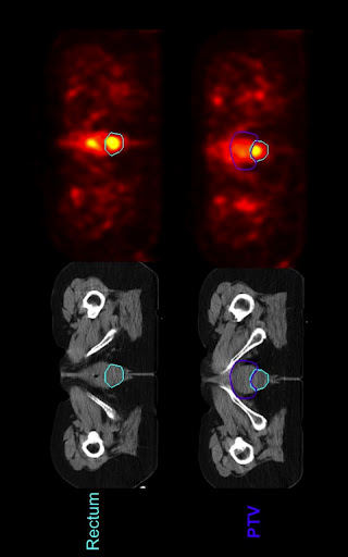 Siriade ORL, Neuro et Sarcome截图1