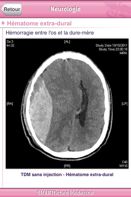 SMARTfiches Neurologie FREE截图1